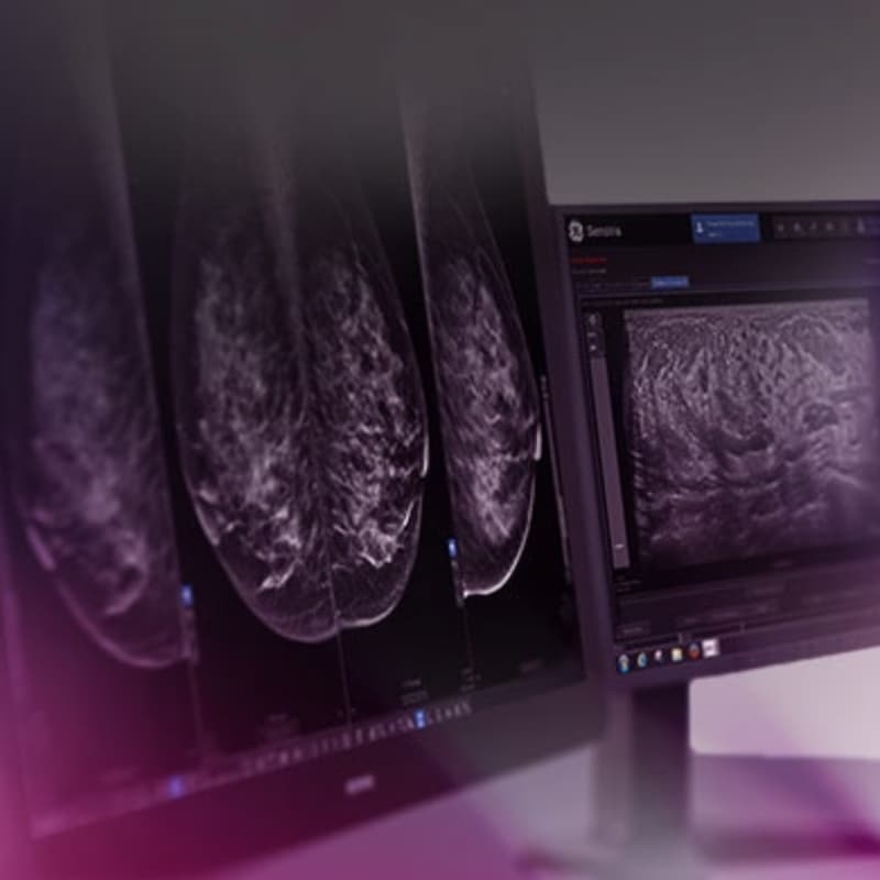 Рабочая станция для маммографии Seno Iris